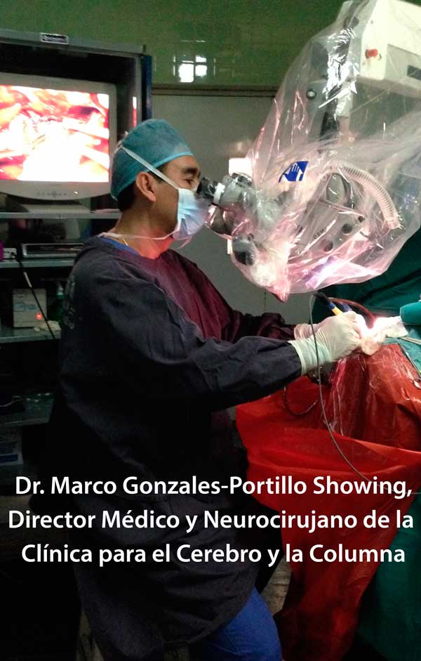 Neurocirugía en Lima